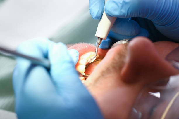 Best Mobile Emergency Dentist in Davenport, WA