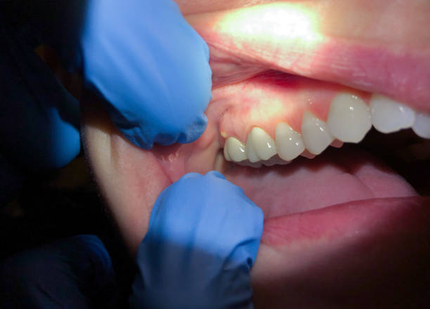 Best Emergency Dental Services for Seniors in Davenport, WA